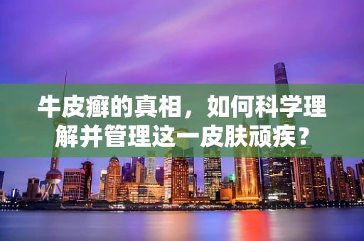 牛皮癣的真相，如何科学理解并管理这一皮肤顽疾？