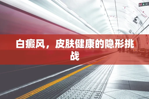 白癜风，皮肤健康的隐形挑战