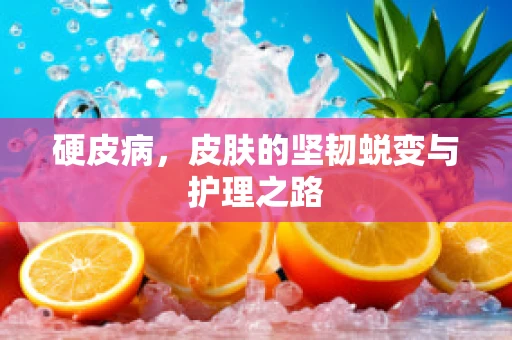 硬皮病，皮肤的坚韧蜕变与护理之路